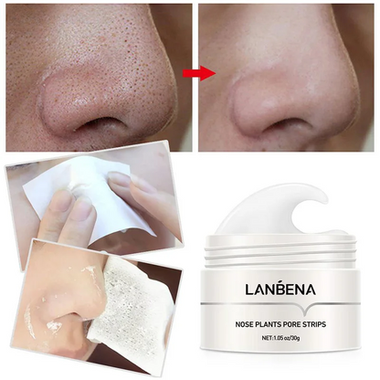 Máscara de Limpeza Nasal com Aloe Vera - Remova Cravos e Acnes com Eficácia Lanb