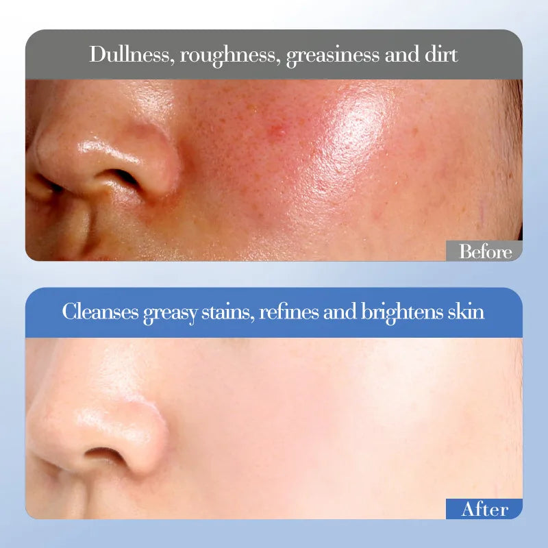 Conjunto de Cuidados Essenciais Use Nuvé – Kit 6 peças